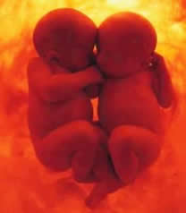 Grand Conversation between twins: Baby 1: And you, you believe in life after birth? Baby 2: Absolutely. It’s obvious that life after birth exist. We are here to become stronger and to get ready for Whatever awaits us next. Baby 1: This is absurd. There is nothing after birth! What would life look like outside the womb? Baby 2: Well, there are many stories about the other side. I’ve heard there is a blaze of light there, an intense and profound feeling of joy with deep emotions, thousands of things to live for… For example, I’ve heard that we’ll eat with our mouth, there. Baby 1: That's silly. We have an umbilical cord and that is how we eat. Everyone knows that we don’t use our mouth to eat! And, on the top of it, no one has ever come back from the other world… Those stories are all coming from naïve people. Life just ends at birth. Period. That’s the way it is and we must accept it. Baby 2: Alright, then allow me to think differently. That's for sure, I have no idea what life after birth looks like, and I can’t prove anything to you. But I like to believe, that in the next world, we’ll be able to see our mother and that she will take care of us. Baby 1: “Mother”? You mean that you believe in ‘Mother’? Oh! So where is she? Baby 2: Everywhere, don’t you see it! She is everywhere, all around us. We are part of her and it's thanks to her that we are living right now. Without her, we wouldn’t be here. Baby 1: This is ridiculous! I’ve never seen any mother so it’s obvious that she doesn’t exist. Baby 2: I don’t agree, that’s your way of seeing things. Because sometimes when everything quiets down a little bit, we can hear her sing. We can feel her hugging our world. I’m pretty sure that our life will start after birth.